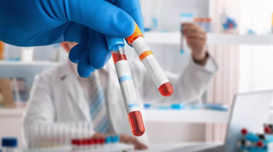 Blood Tests