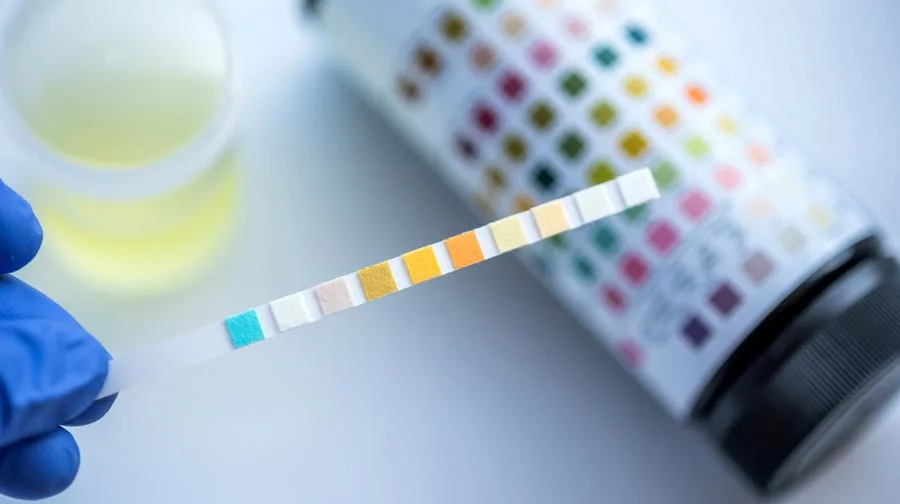 Breaking The Drug Test Cycle
