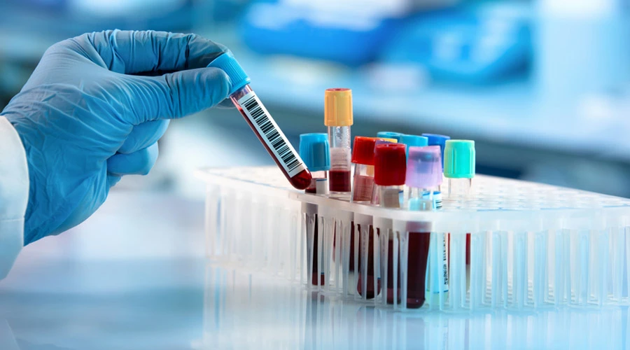 Employers Drug Testing