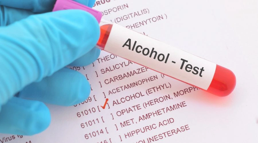 Drinking Alcohol Affect Drug Test