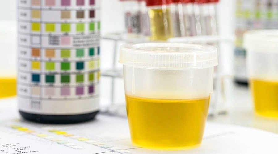 Urine test for drug and alcohol test